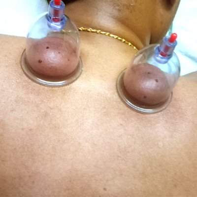 naturopathy treatment